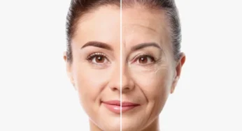 “Ozempic Face” Emerges as Common Side Effect of GLP‑1 Weight Loss Drugs