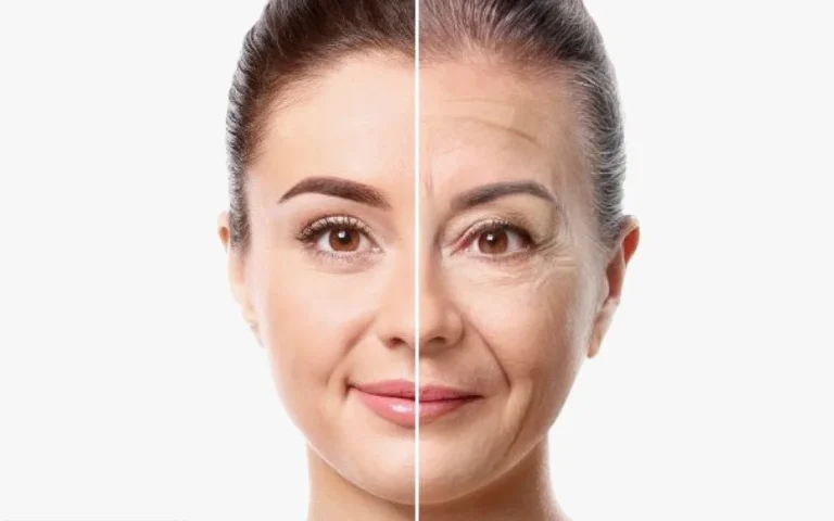 “Ozempic Face” Emerges as Common Side Effect of GLP‑1 Weight Loss Drugs