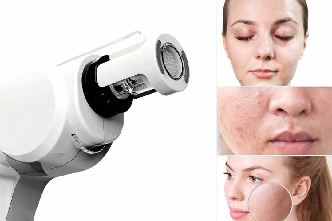 Spicule Skincare The Secret to Smoother, Brighter, and Healthier Skin